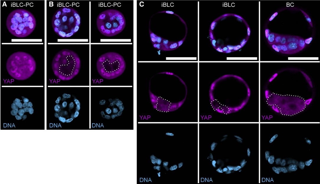 YAP polarization in iBLCs – Cody Kime reprogramming